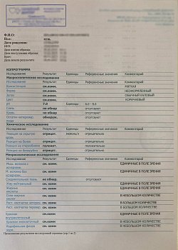 Общий анализ кала 219 у